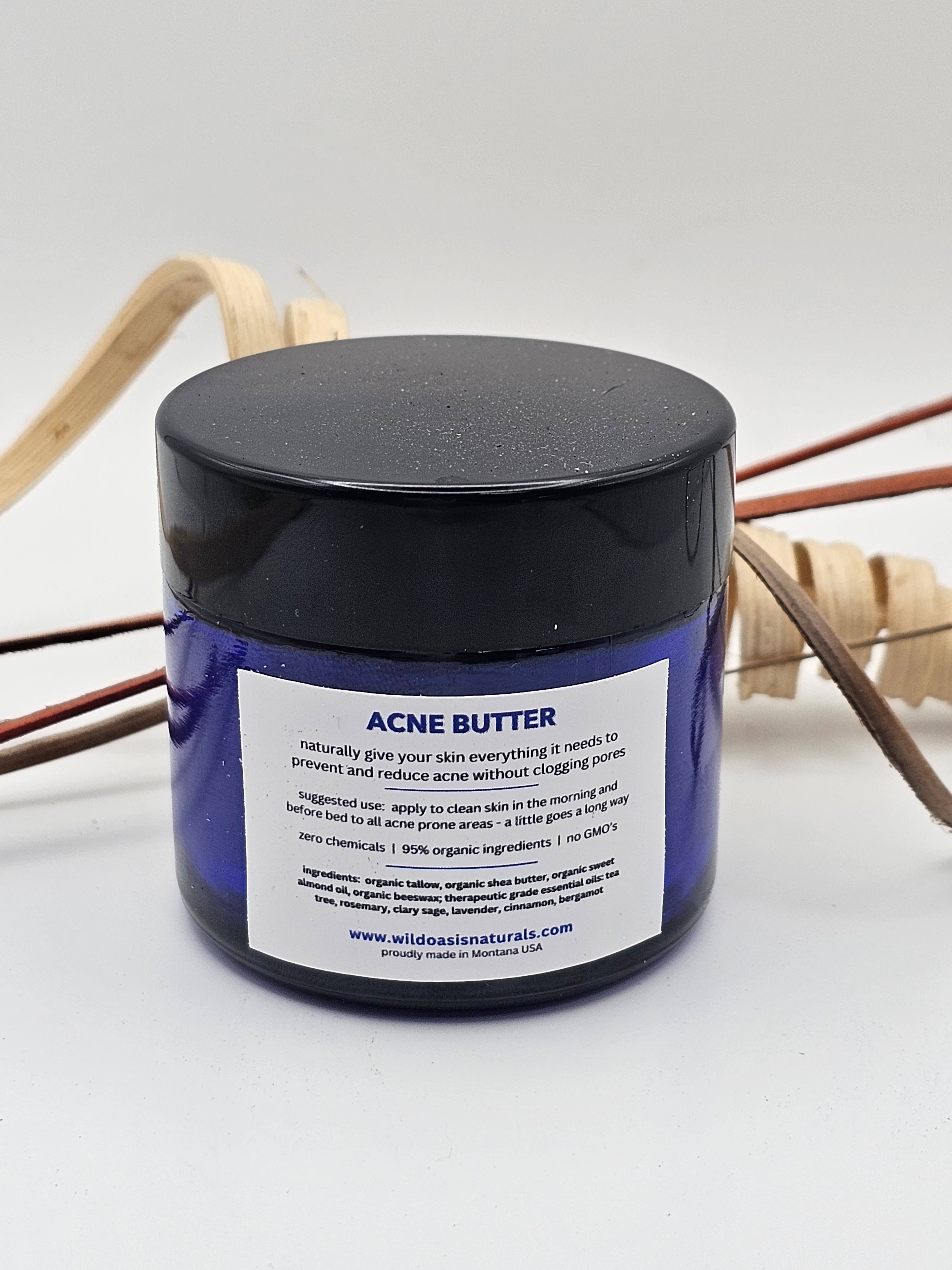 Acne Butter - Organic Tallow Anti-Acne Cream