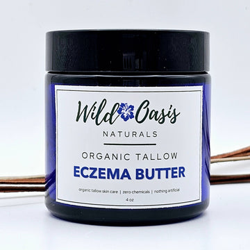 Eczema Butter - 4 oz - Organic Tallow Eczema/Psoriasis Cream