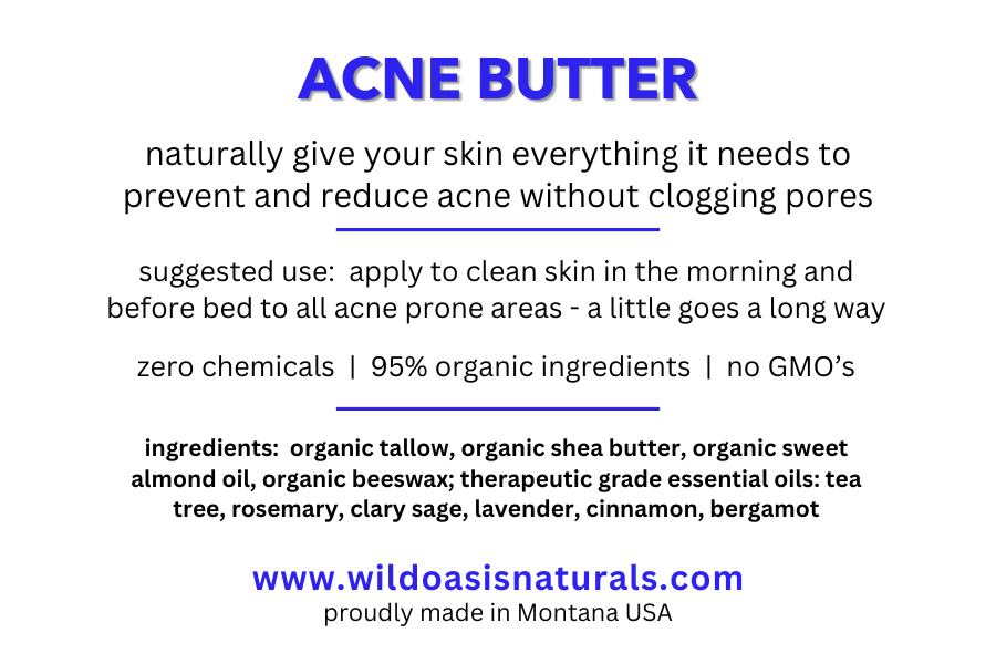 Acne Butter - Organic Tallow Anti-Acne Cream