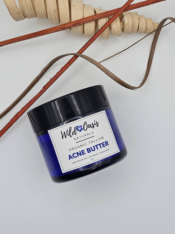 Acne Butter - Organic Tallow Anti-Acne Cream