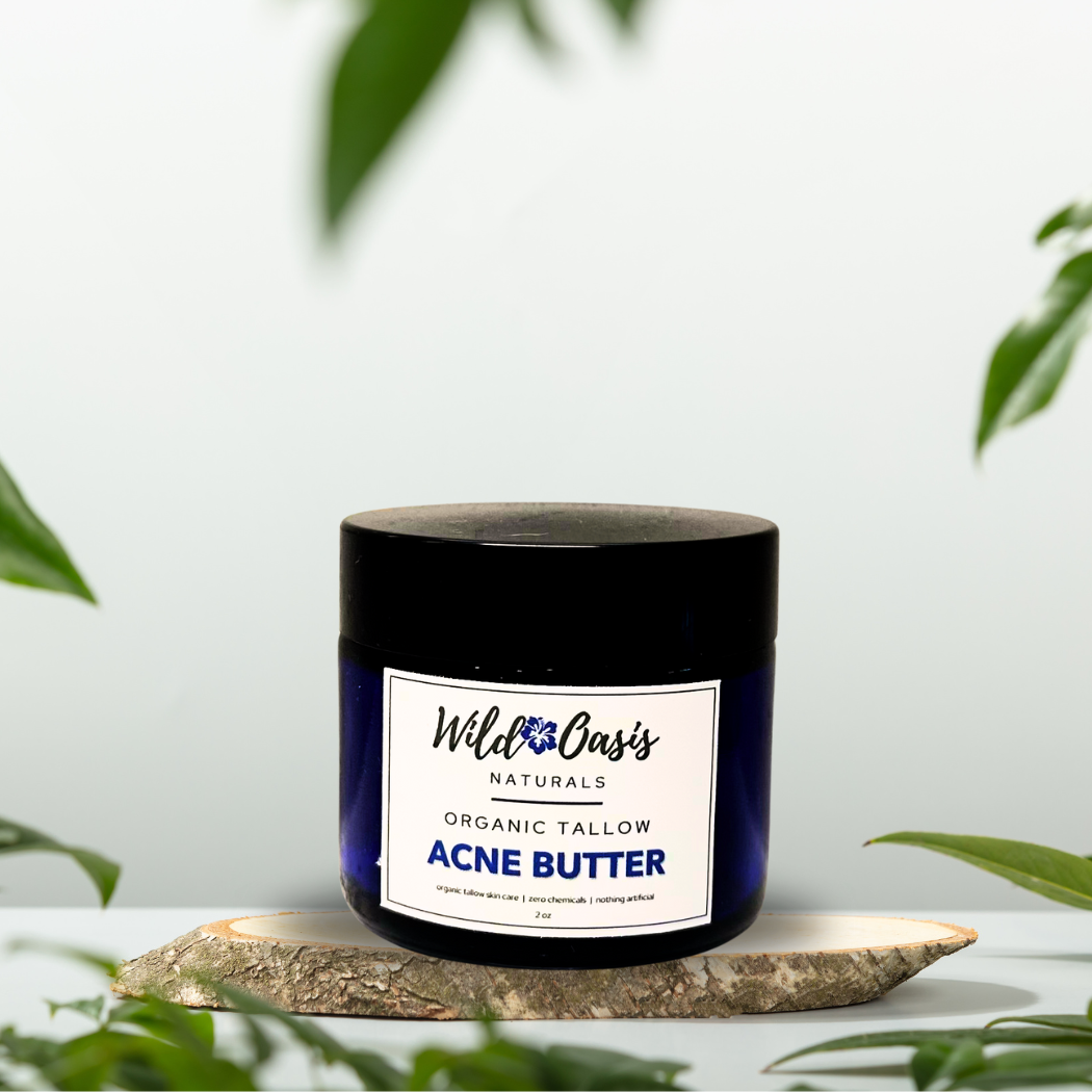Acne Butter - Organic Tallow Anti-Acne Cream