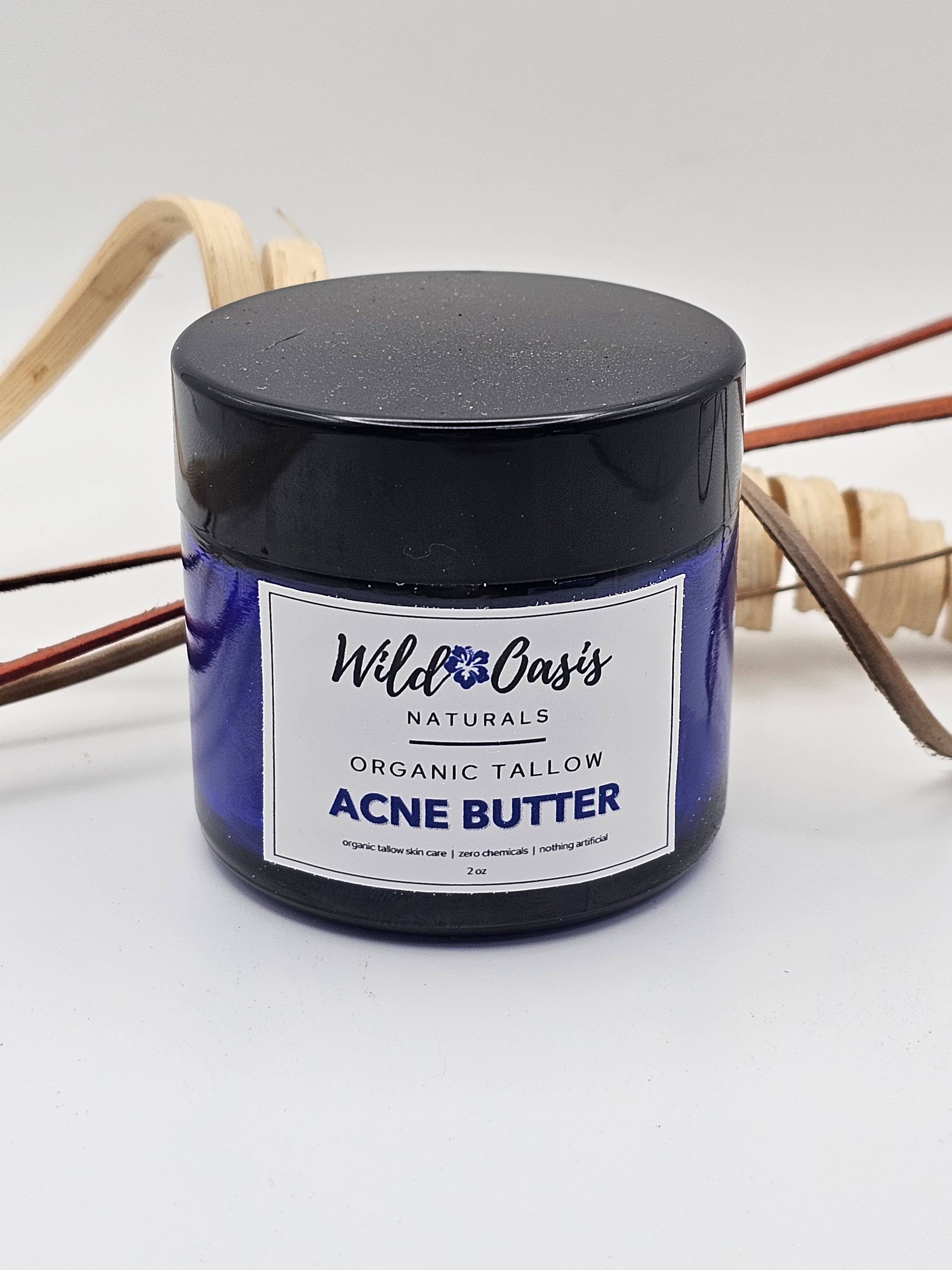 Acne Butter - Organic Tallow Anti-Acne Cream